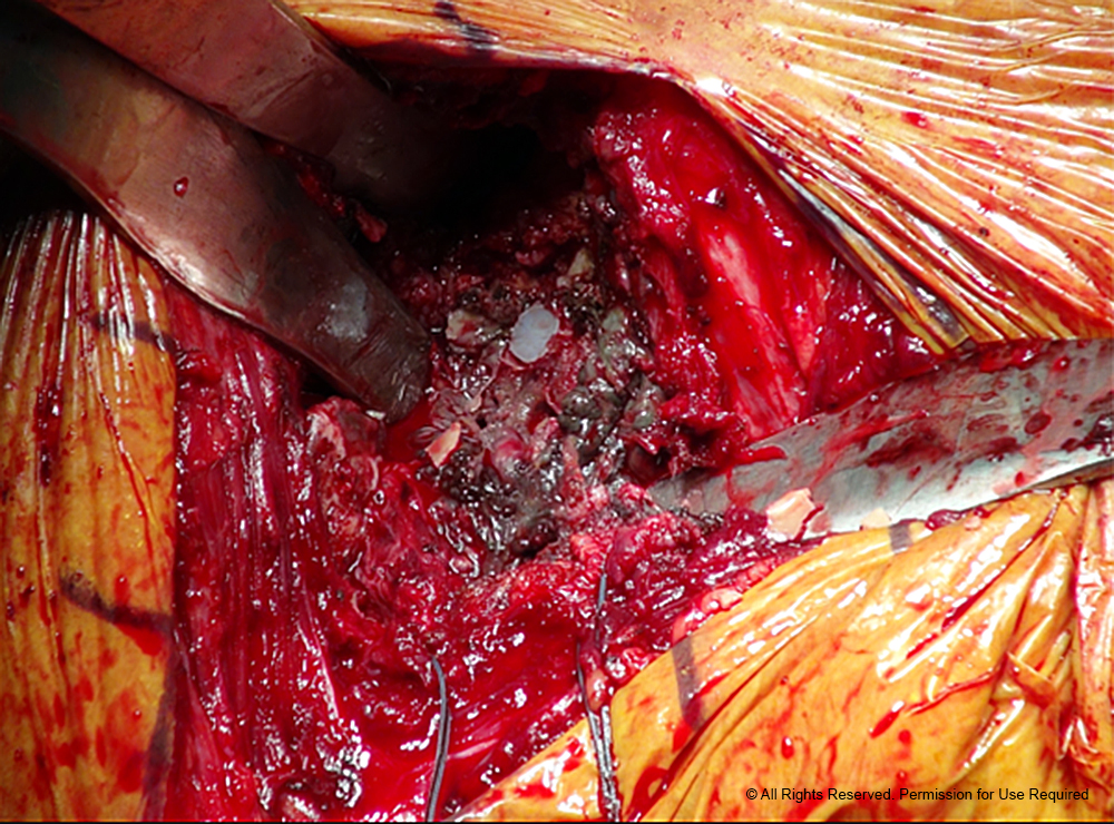 The Orthopaedic Journal at Harvard Medical School | Article