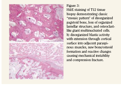 Mosaic Pattern Disease | discussion Mosaic Pattern Disease | discussion