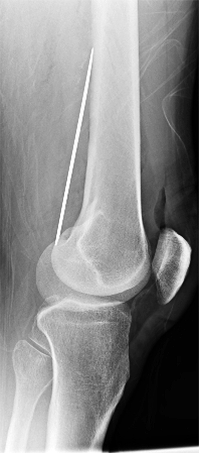 Sharps Figure 3