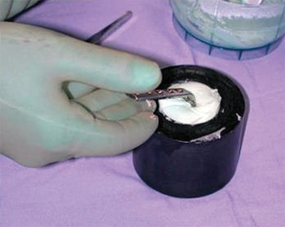 Prostalac Figure 1