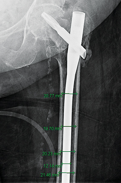 BladeCut Figure 2