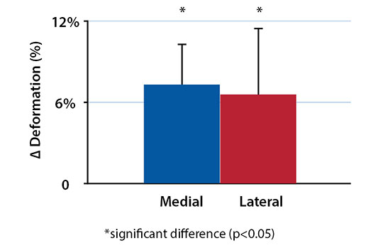 Residual Joint Laxity and Increased Cartilage Contact Deformation in ACL Reconstructed Knees Figure 2