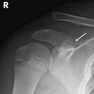 Average Number of Injuries Figure 2