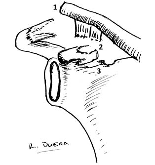 Triple Injury Figure 3