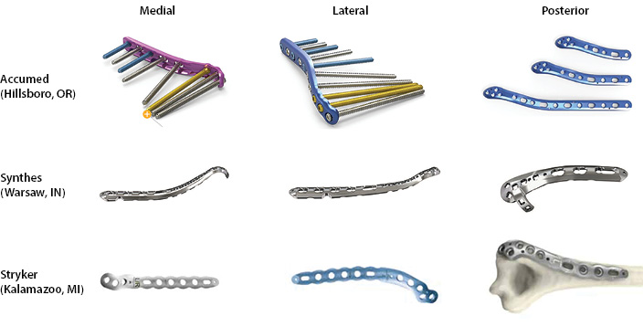 Surgical Fixation Distal Humerus Figure 2