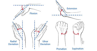 3D CT Wrist Figure 1