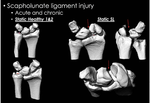 3D CT Wrist Figure 6