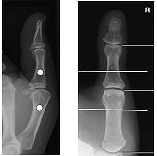 3D CT Wrist Figure 2