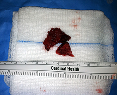 Figure 4b