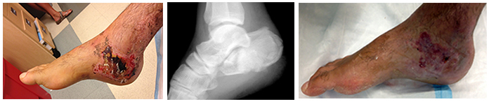 Figure 6A