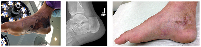 Figure 6B