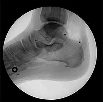 Figure 13