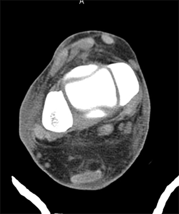 Figure 16